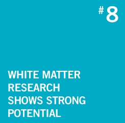 White Matter Research Shows Strong Potential